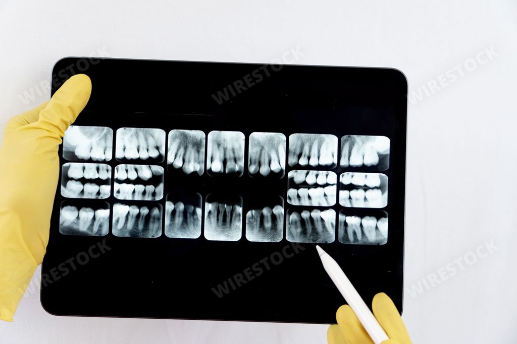 The dentist checking the x-ray on an iPad to indicate his dental treatment to the patient
