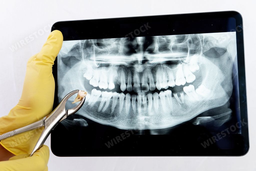 The dentist checking the x-ray on an iPad to indicate his dental treatment to the patient